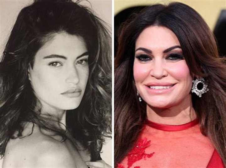 Transformations Unveiled: Kimberly Guilfoyle Before and After Pics